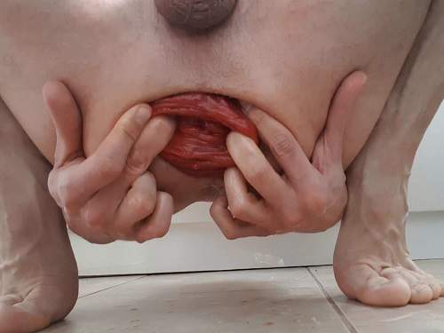 500px x 375px - Amateur male hardcore stretching his giant anal prolapse â€“ anal stretching,  closeup download free fisting at our extreme porn hub