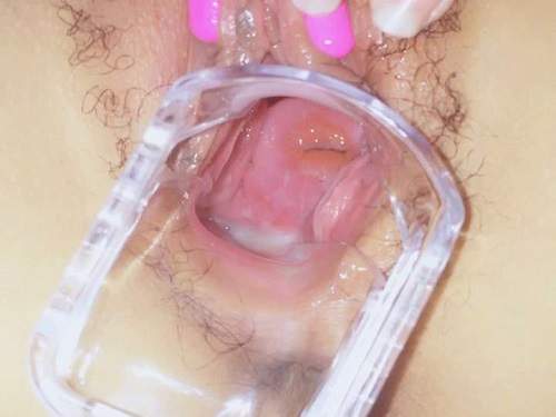 Miaotututu finger vs. vaginal dilator – Premium user Request - speculum examination, hairy pussy