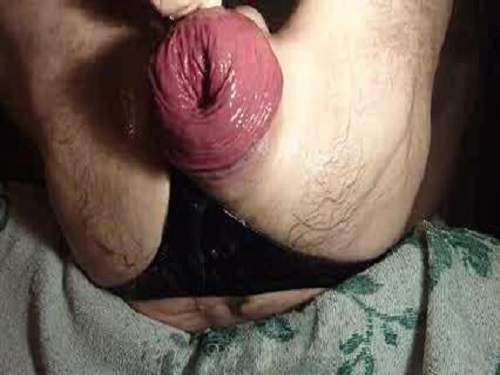 Amateur Man Monster Asshole Prolapse Fisting Anal Gay Fisting