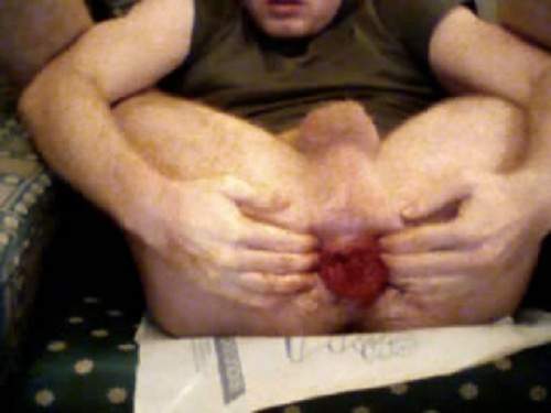 Bloody Gay Porn - Webcam man bloody fisting anal and rosebutt ass â€“ gay fisting, gay rosebutt  download free fisting at our extreme porn hub