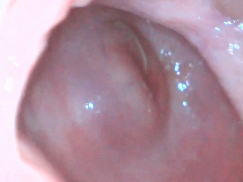 Makinbiscuits Endoscope cervix exploration unique amateur - webcam teen, pussy insertion