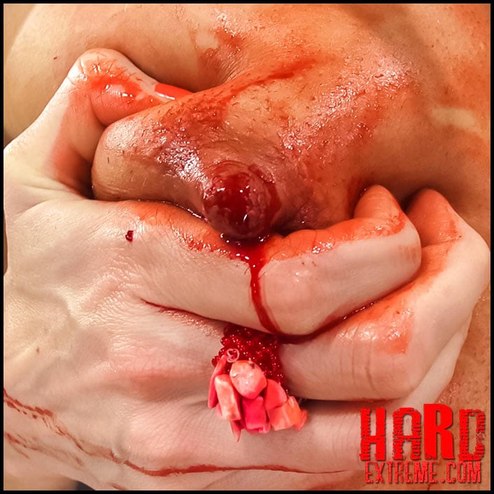 Hirudo, M.D. â€“ Queensect Porn â€“ Leechesâ€¦ Painâ€¦ Blood download free fisting  at our extreme porn hub